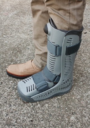 Similar Symptoms Exist Between Broken Ankles and Sprained Ankles