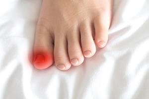 Ingrown Toenails and When They Need Attention