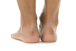 Understanding Haglund&rsquo;s Syndrome in Women