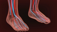 Symptoms of Poor Circulation In the Feet