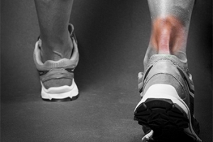 Achilles Tendon Injuries in Athletes