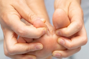 Signs and Causes of Athlete&rsquo;s Foot
