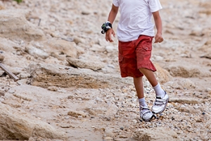 Clubfoot Causes and Care