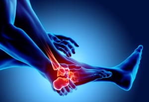 Why Do Foot Stress Fractures Happen?