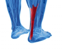 Achilles Tendon Injuries Can Cause Severe Pain