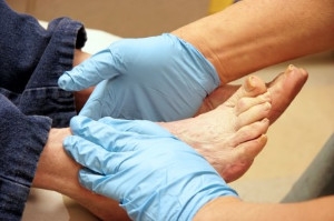 Chronic Conditions and Their Effect on Foot Health